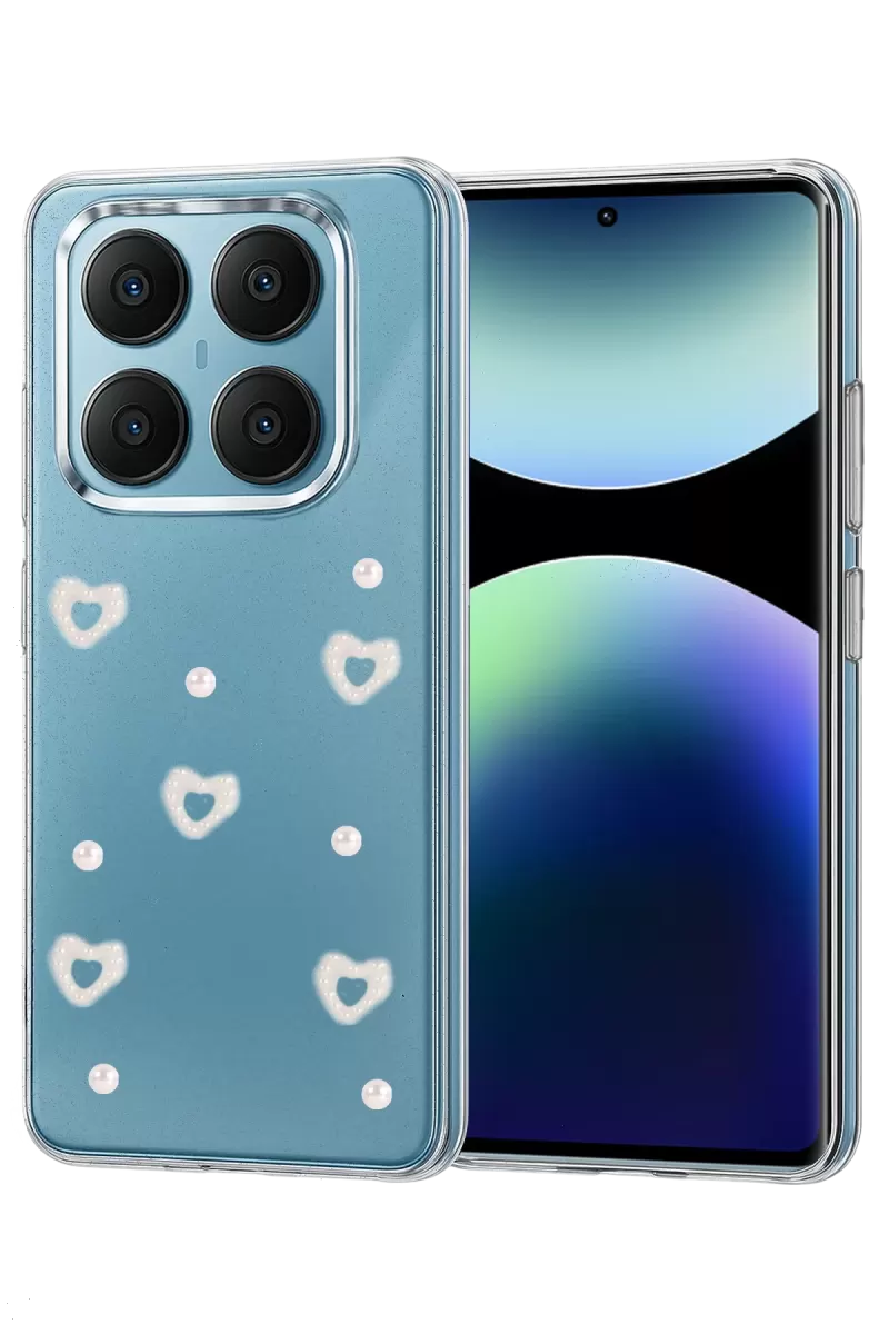 Newface Xiaomi Redmi Note 14 Pro 4G Fiyonk Desenli Kapak - Desen 10
