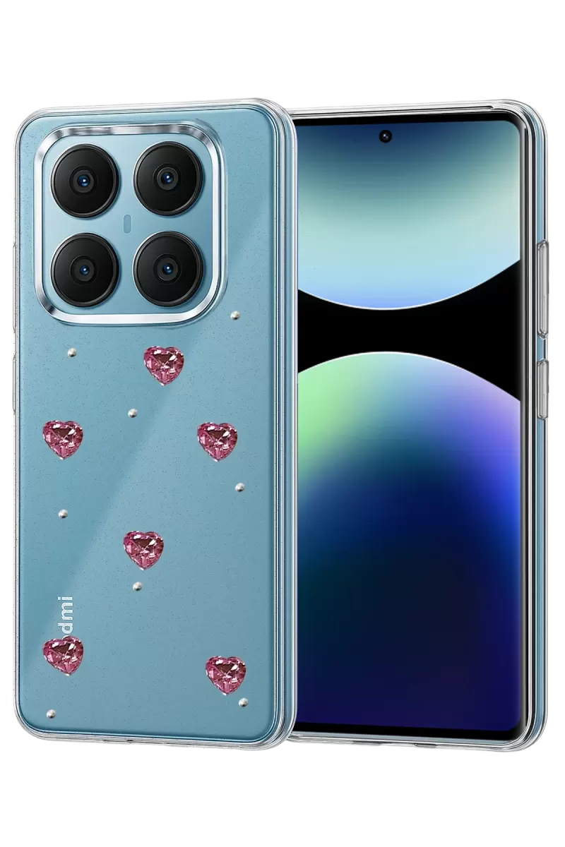 Newface Xiaomi Redmi Note 14 Pro 4G Fiyonk Desenli Kapak - Desen 3