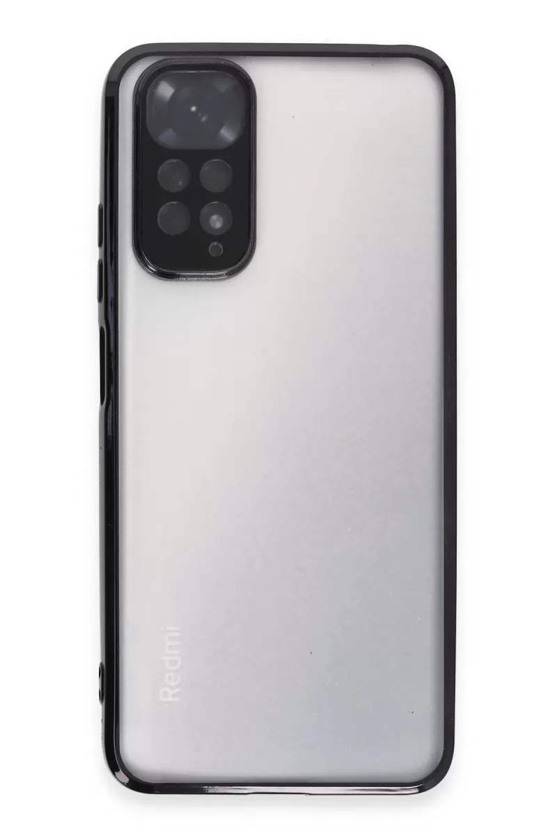 Newface Xiaomi Redmi Note 11 Kılıf Razer Lensli Silikon - Siyah