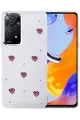 Newface Xiaomi Redmi Note 11 Pro Fiyonk Desenli Kapak - Desen 3