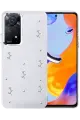 Newface Xiaomi Redmi Note 11 Pro Fiyonk Desenli Kapak - Desen 4