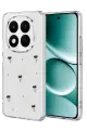 Newface Xiaomi Redmi Note 15 Pro 5G Fiyonk Desenli Kapak - Desen 1