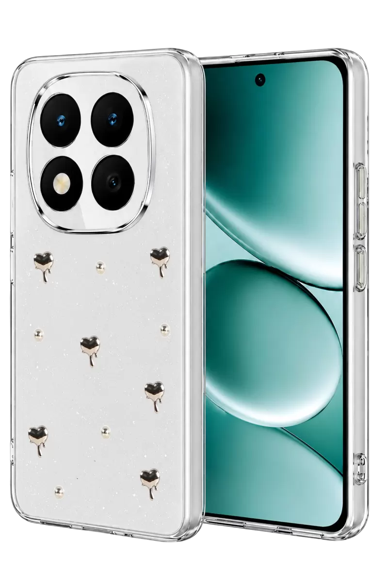 Newface Xiaomi Redmi Note 15 Pro Plus 5G Fiyonk Desenli Kapak - Desen 1
