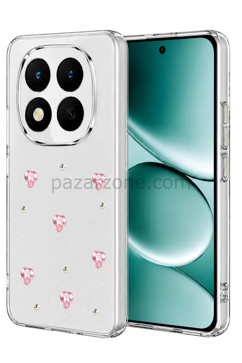 Newface Xiaomi Redmi Note 15 Pro Plus 5G Fiyonk Desenli Kapak - Desen 3