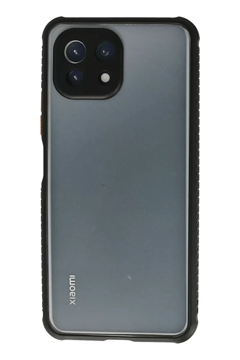 Newface Xiaomi Mİ 11 Lite Kılıf Miami Şeffaf Silikon - Siyah