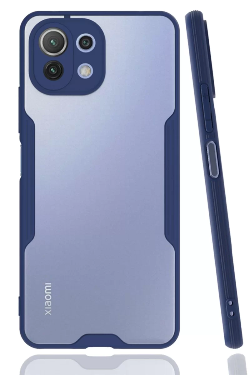 Newface Xiaomi Mİ 11 Lite Kılıf Platin Silikon - Lacivert