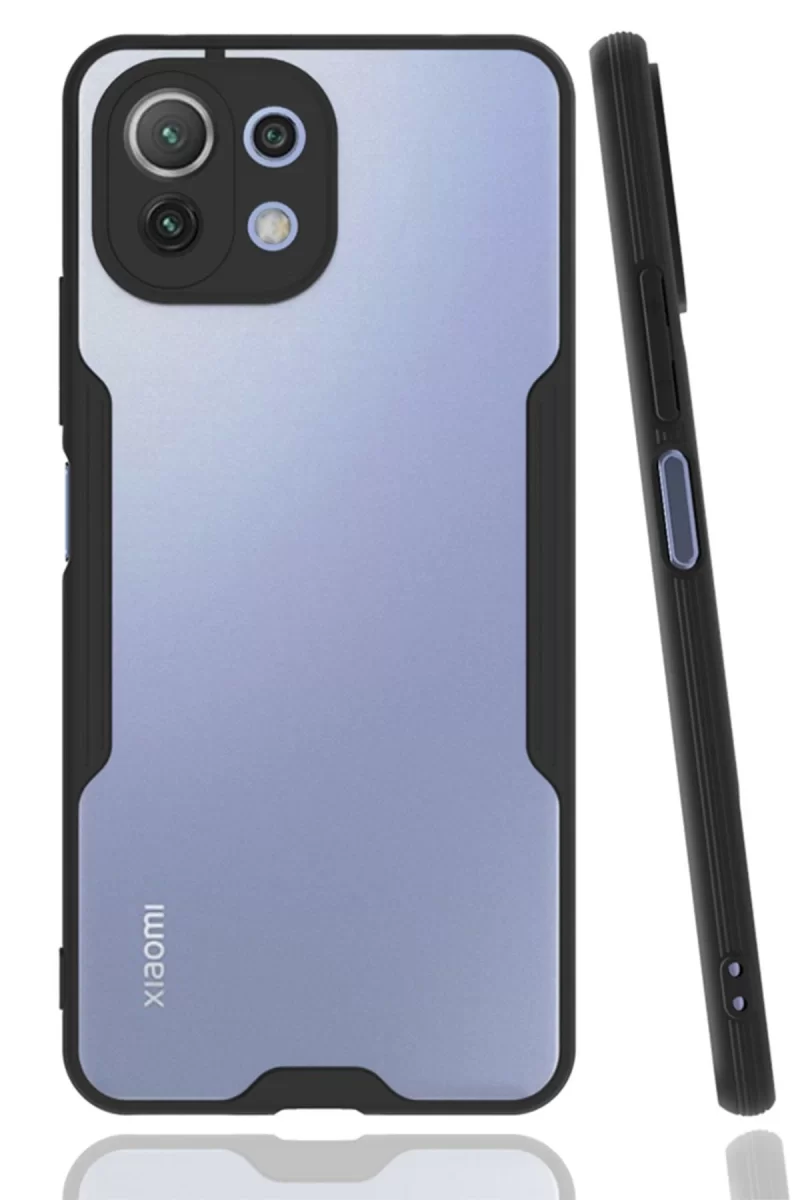 Newface Xiaomi Mİ 11 Lite Kılıf Platin Silikon - Siyah