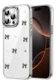 Newface Apple iPhone 15 Pro Max Fiyonk Desenli Kapak - Desen 8